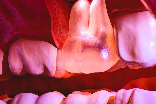Bestudeer de tanden in de mond bij CORPUS reis door de mens